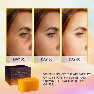 Kojic Acid Dark Spot Remover Whitening Soap Handmade