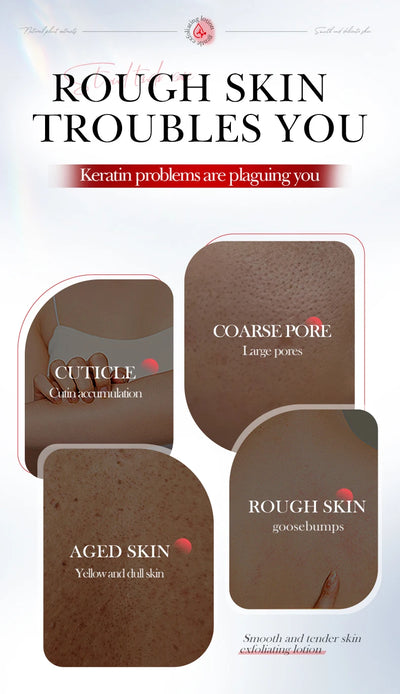 SADOER Kojic Acid Whitening Face Lotion Anti-Freckle Moisturizing