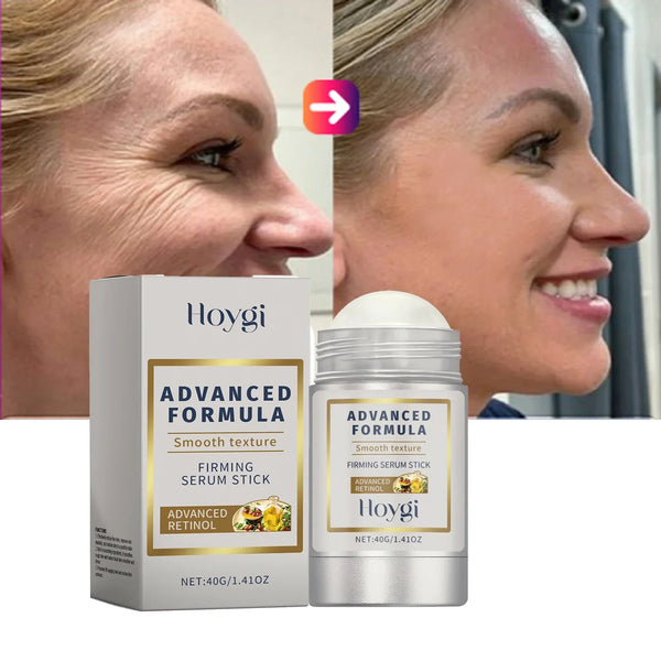 Retinol Hyaluronic Acid Stick Anti Wrinkle