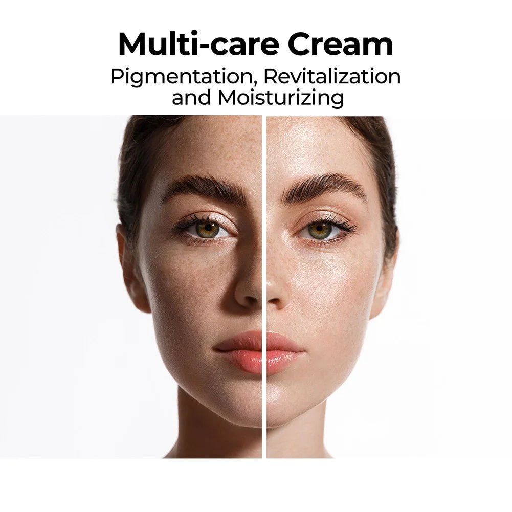 20g Skin Brightening Cream Dark Spot Remover