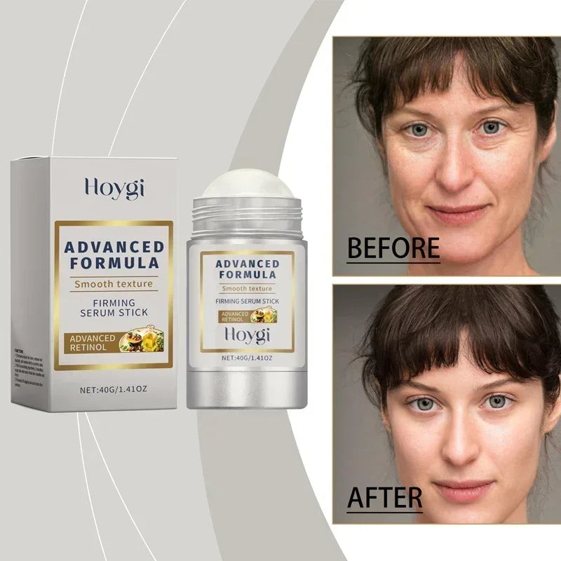 Retinol Hyaluronic Acid Stick Anti Wrinkle
